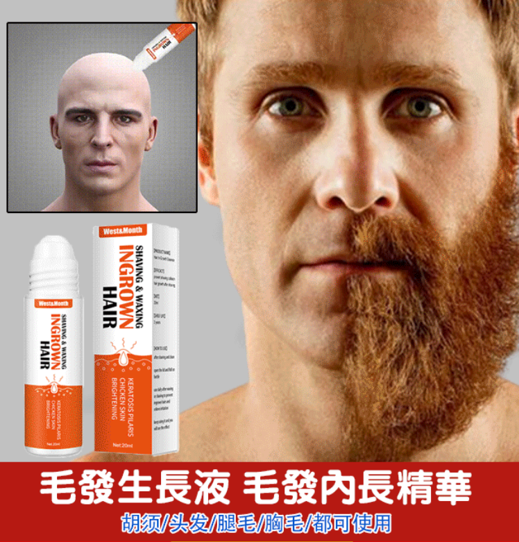 買二送一!West&Month毛髮逆生長精華