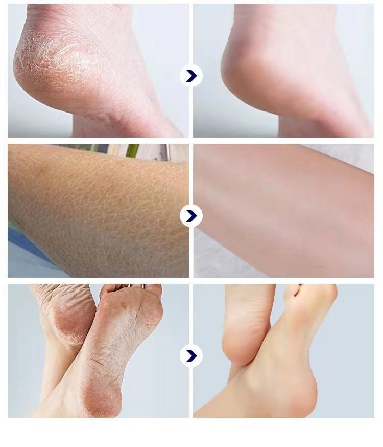 1694436796512091.png 8836e4a35db1bb44ce44bb7be177150.png